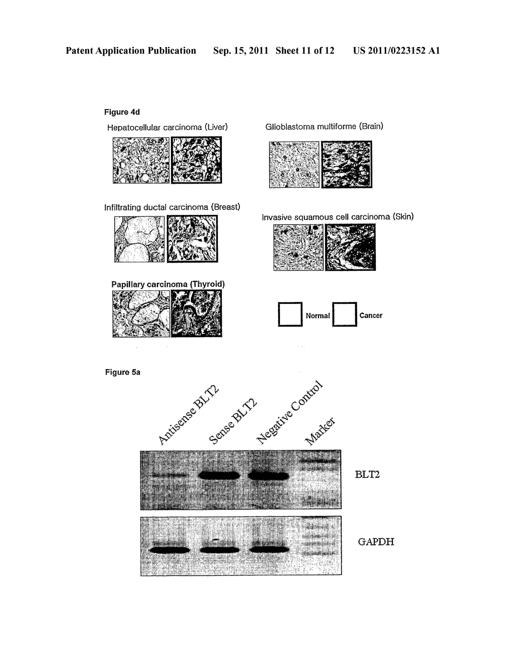 USE OF INHIBITORS OF LEUKOTRIENE B4 RECEPTOR BLT2 FOR TREATING HUMAN     CANCERS - diagram, schematic, and image 12