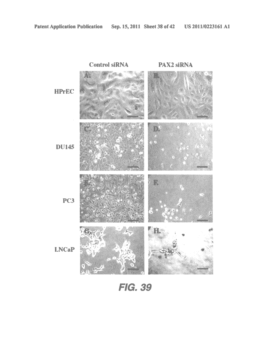 TARGETING PAX2 FOR THE TREATMENT OF BREAST CANCER - diagram, schematic, and image 39