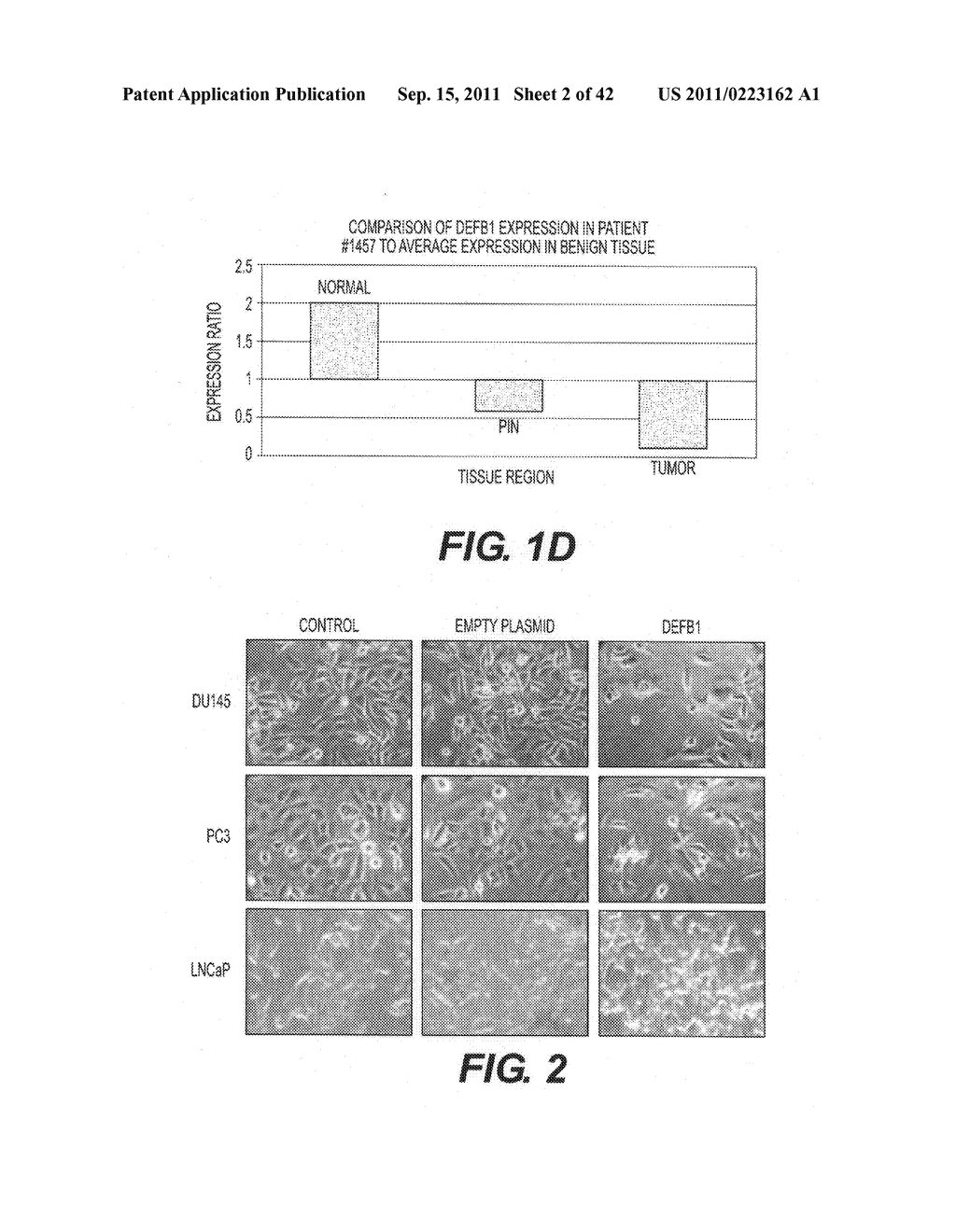 TARGETING PAX2 FOR THE TREATMENT OF BREAST CANCER - diagram, schematic, and image 03