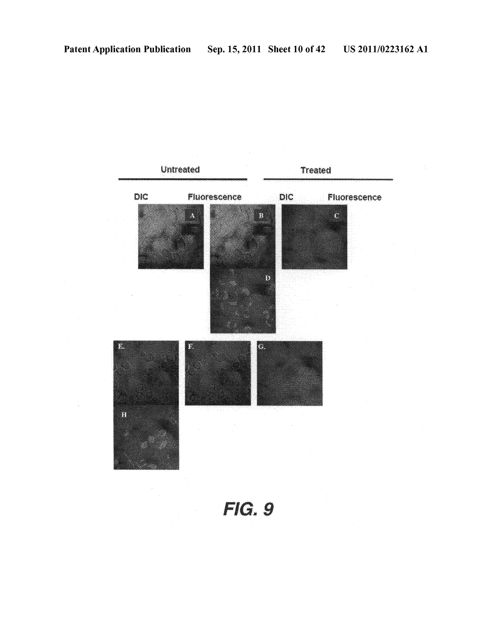 TARGETING PAX2 FOR THE TREATMENT OF BREAST CANCER - diagram, schematic, and image 11