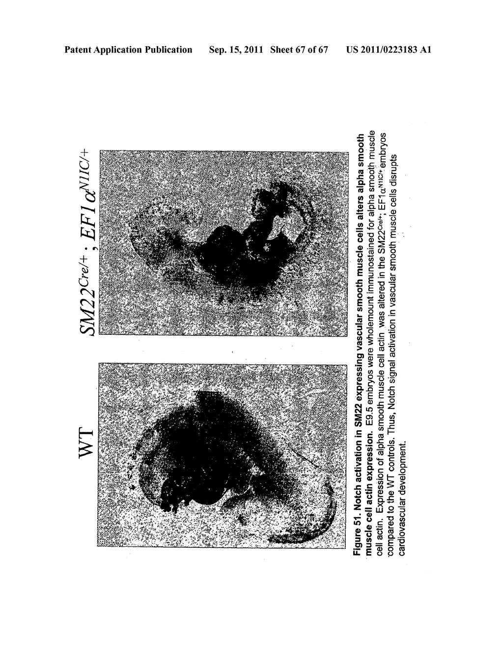 HUMAN NOTCH3 BASED FUSION PROTEINS AS DECOY INHIBITORS OF NOTCH3 SIGNALING - diagram, schematic, and image 68