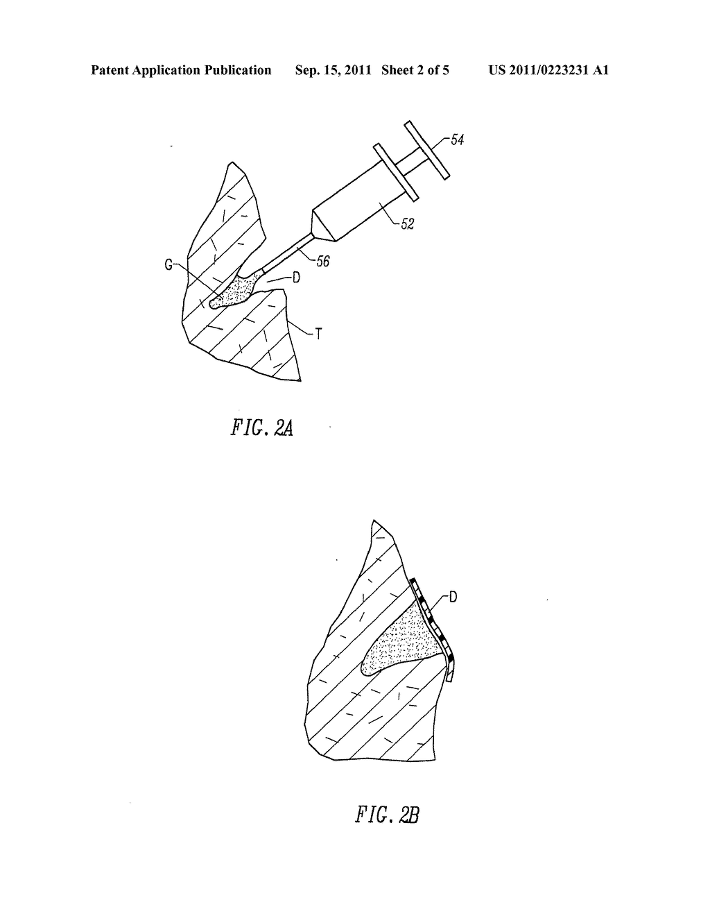 FRAGMENTED POLYMERIC COMPOSITIONS AND METHODS FOR THEIR USE - diagram, schematic, and image 03