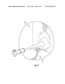 Process For Guniting Refractory Mixes Using Conventional Dry Gunning     Equipment and Refractory Mixes for Use in Same diagram and image