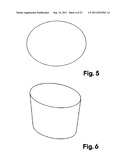 Dental Implant diagram and image