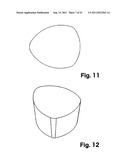 Dental Implant diagram and image