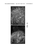 COMPOSITIONS FOR INDUCING DIFFERENTIATION INTO RETINAL CELLS FROM RETINAL     PROGENITOR CELLS OR INDUCING PROLIFERATION OF RETINAL CELLS COMPRISING     WNT SIGNALING PATHWAY ACTIVATORS diagram and image