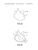 BRA AND/OR BRA PAD FOR PROVIDING THE APPEARANCE OF SYMMETRY TO     ASYMMETRICAL BREASTS diagram and image