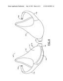 BRA AND/OR BRA PAD FOR PROVIDING THE APPEARANCE OF SYMMETRY TO     ASYMMETRICAL BREASTS diagram and image