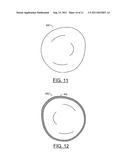 BRA AND/OR BRA PAD FOR PROVIDING THE APPEARANCE OF SYMMETRY TO     ASYMMETRICAL BREASTS diagram and image