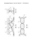 STABILITY EXERCISE MACHINE diagram and image