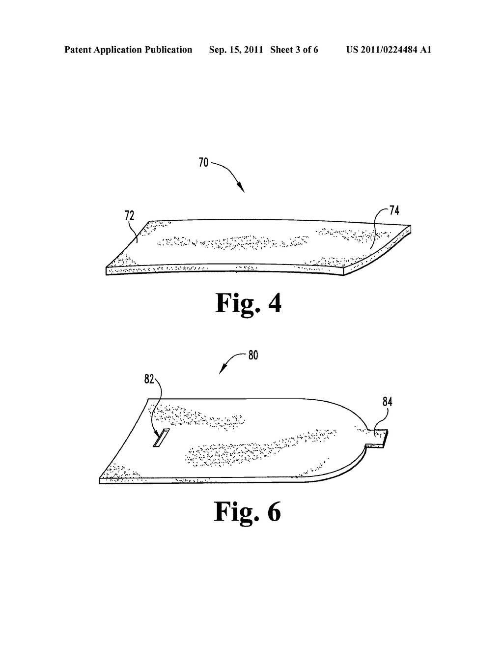 METHODS FOR MODIFYING VASCULAR VESSEL WALLS - diagram, schematic, and image 04