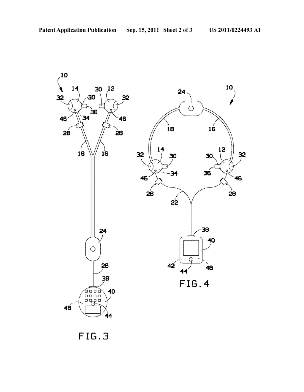 EAR AILMENT DIAGNOSTIC DEVICE AND METHOD - diagram, schematic, and image 03