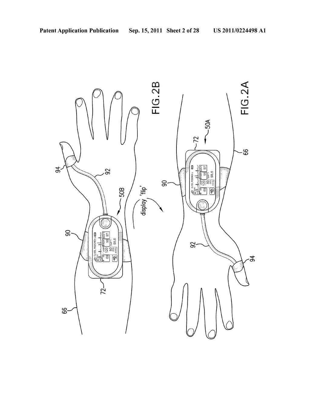 BODY-WORN VITAL SIGN MONITOR - diagram, schematic, and image 03