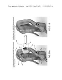 BODY-WORN VITAL SIGN MONITOR diagram and image