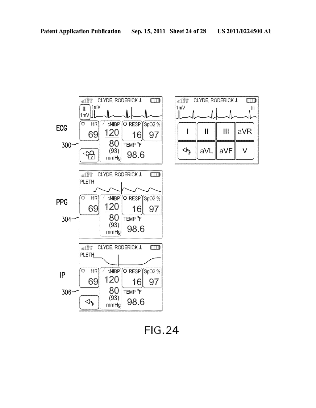 BODY-WORN VITAL SIGN MONITOR - diagram, schematic, and image 25