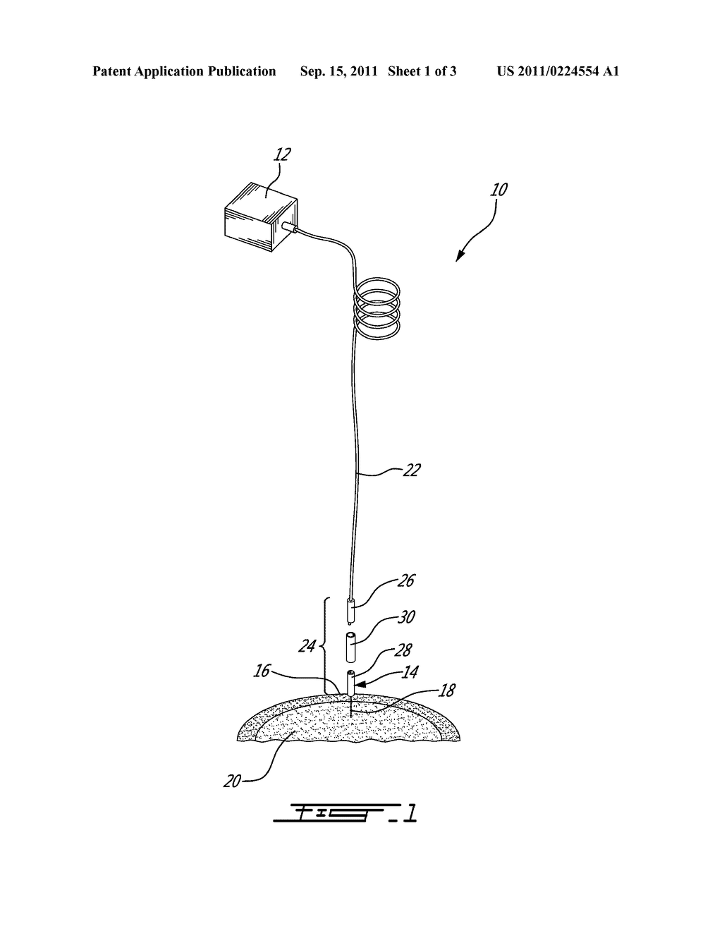 Optogenetic Fiber Optic Cannula and Adapted Fiber Optic Connector - diagram, schematic, and image 02