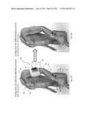 BODY-WORN VITAL SIGN MONITOR diagram and image