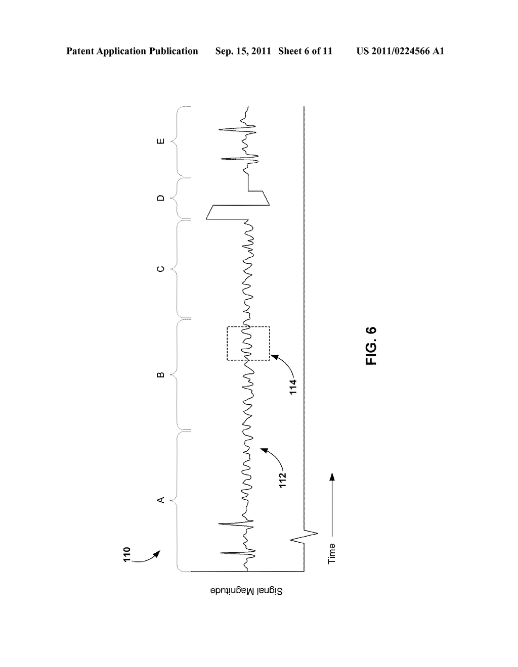 LEAD INTEGRITY TESTING DURING SUSPECTED TACHYARRHYTHMIAS - diagram, schematic, and image 07