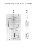 Intubation monitoring apparatus and method diagram and image