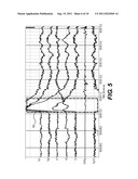 METHOD AND DEVICE FOR REMOVING EEG ARTIFACTS diagram and image