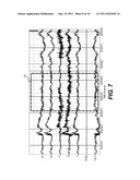 METHOD AND DEVICE FOR REMOVING EEG ARTIFACTS diagram and image