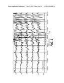 METHOD AND DEVICE FOR REMOVING EEG ARTIFACTS diagram and image