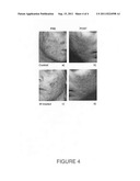 Radiant near infrared light emitting diode exposure as skin preparation diagram and image