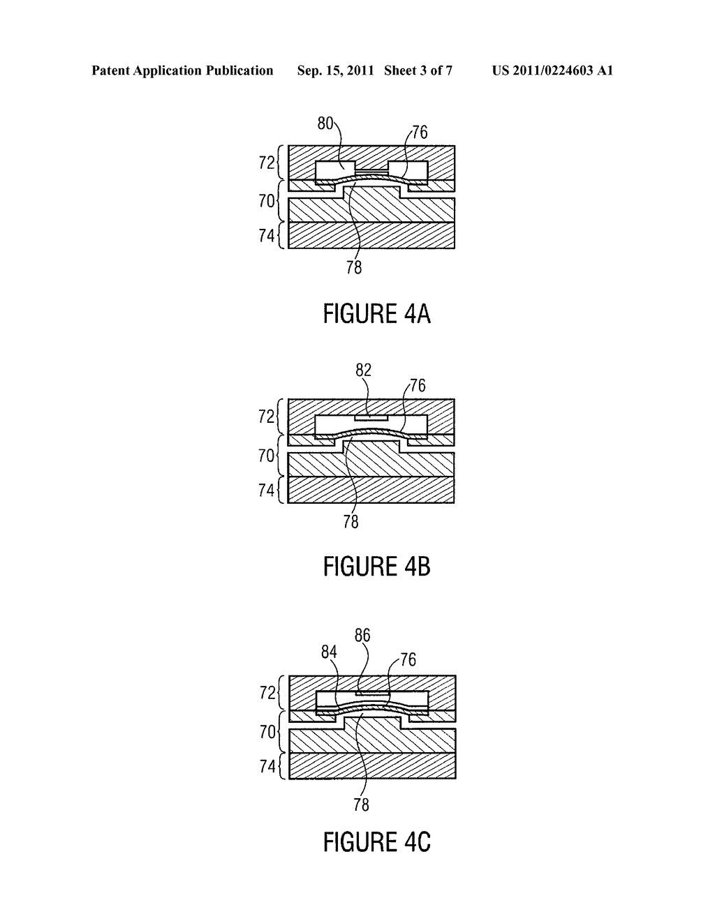 DEVICE AND METHOD FOR DETERMINING AT LEAST ONE FLOW PARAMETER - diagram, schematic, and image 04