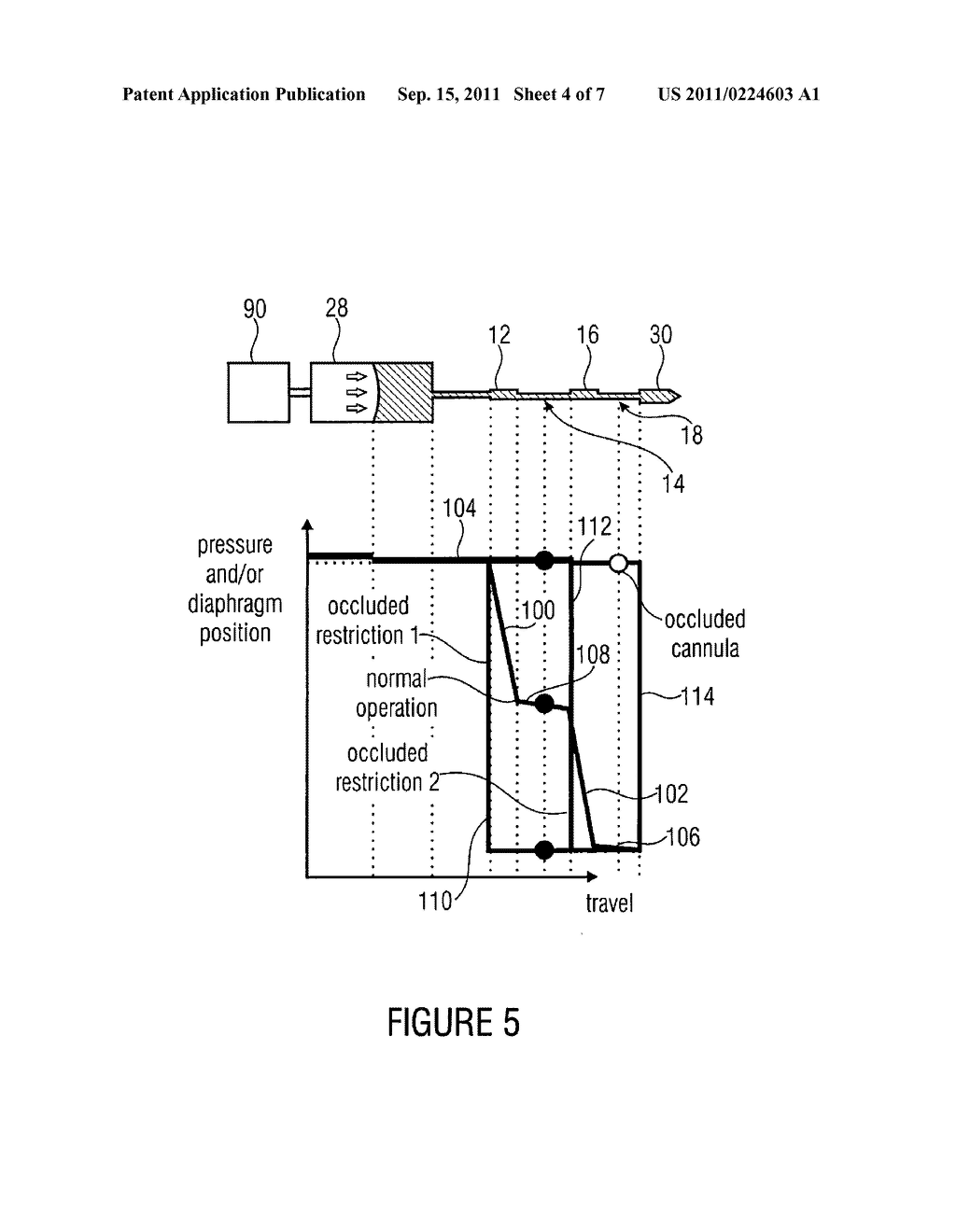 DEVICE AND METHOD FOR DETERMINING AT LEAST ONE FLOW PARAMETER - diagram, schematic, and image 05