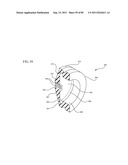 MEDICAL DEVICE INCLUDING AN AIR EVACUATION SYSTEM diagram and image