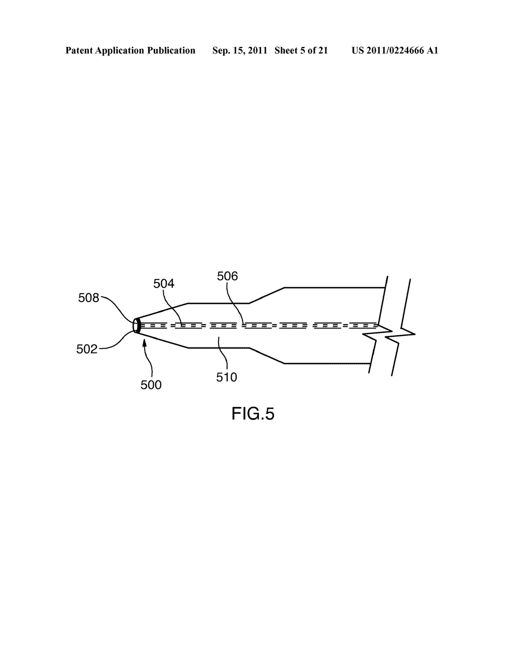 METHOD OF SURGICAL PERFORATION VIA THE DELIVERY OF ENERGY - diagram, schematic, and image 06