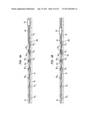 CLIP APPLIER CONFIGURED TO PREVENT CLIP FALLOUT diagram and image