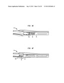 CLIP APPLIER CONFIGURED TO PREVENT CLIP FALLOUT diagram and image