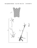 IMPLANTABLE SUPPORT ATTACHMENT SYSTEM AND ASSEMBLY diagram and image