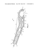 IMPLANTABLE SUPPORT ATTACHMENT SYSTEM AND ASSEMBLY diagram and image