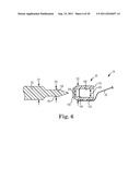 IMPLANTABLE SUPPORT ATTACHMENT SYSTEM AND ASSEMBLY diagram and image