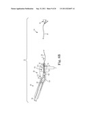 IMPLANTABLE SUPPORT ATTACHMENT SYSTEM AND ASSEMBLY diagram and image