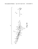 IMPLANTABLE SUPPORT ATTACHMENT SYSTEM AND ASSEMBLY diagram and image