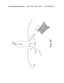 IMPLANTABLE SUPPORT ATTACHMENT SYSTEM AND ASSEMBLY diagram and image