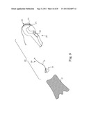 IMPLANTABLE SUPPORT ATTACHMENT SYSTEM AND ASSEMBLY diagram and image