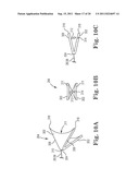 IMPLANTABLE SUPPORT ATTACHMENT SYSTEM AND ASSEMBLY diagram and image