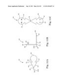 IMPLANTABLE SUPPORT ATTACHMENT SYSTEM AND ASSEMBLY diagram and image