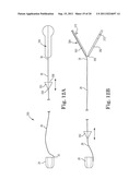 IMPLANTABLE SUPPORT ATTACHMENT SYSTEM AND ASSEMBLY diagram and image