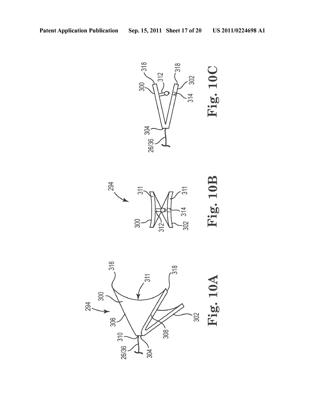 IMPLANTABLE SUPPORT ATTACHMENT SYSTEM AND ASSEMBLY - diagram, schematic, and image 18