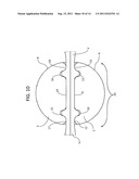 Surgical Clips For Laparoscopic Procedures diagram and image