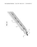 Surgical Clips For Laparoscopic Procedures diagram and image