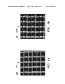 PROSTHETIC DEVICE HAVING DIAGONAL YARNS AND METHOD OF MANUFACTURING THE     SAME diagram and image