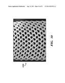 PROSTHETIC DEVICE HAVING DIAGONAL YARNS AND METHOD OF MANUFACTURING THE     SAME diagram and image