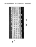 PROSTHETIC DEVICE HAVING DIAGONAL YARNS AND METHOD OF MANUFACTURING THE     SAME diagram and image