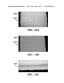 PROSTHETIC DEVICE HAVING DIAGONAL YARNS AND METHOD OF MANUFACTURING THE     SAME diagram and image